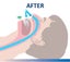 Anti Snore Guard Device Stop Snoring Mouthpiece anti-snoring Mouthguard Carousel 13