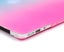MacBook Air 11 Case Carousel 5