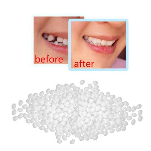 Temporary Tooth Repair Kit, Thermal Beads for Filling Gaps or Fixing the Missing Carousel 2