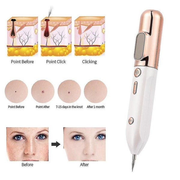 9 Level LCD Plasma Pen LED Lighting Home Use Beauty Devices Carousel 2
