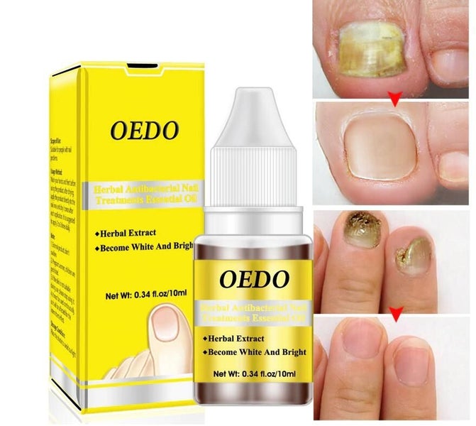 Nail Essence Oil Nail Treatment Essence Carousel 1