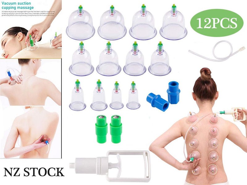 Vacuum Cupping Set (Auckland Stock) Carousel 1