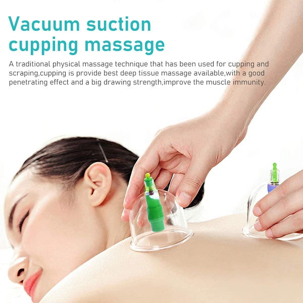 Vacuum Cupping Set (Auckland Stock) Carousel 2