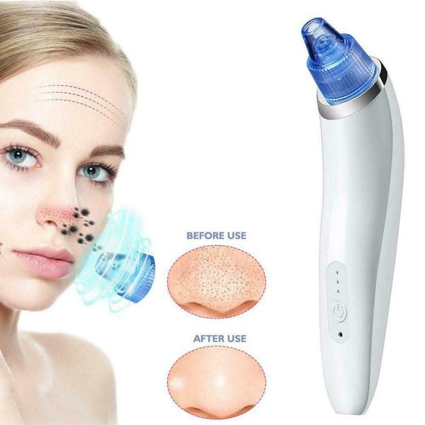 Vacuum Pore Cleaner Blackhead Remover Electric Acne Exfoliating USB NEW Carousel 8