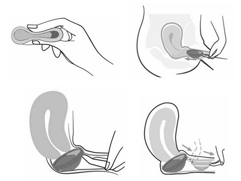 45ml Women Leak Proof Menstrual Cup Reusable Silicone Period Disc Pink Carousel 4