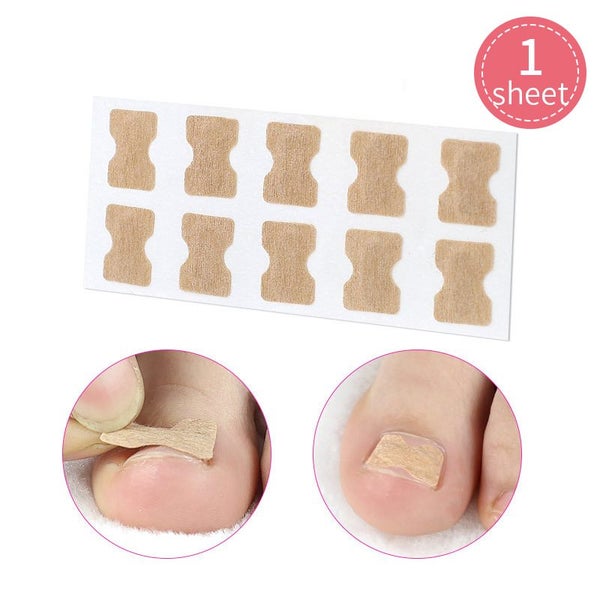Toe nail Corrector Stickers Paronychia Treatment Pedicure Toe Nail Carousel 1