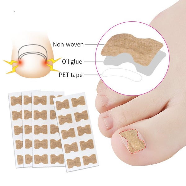 Toe nail Corrector Stickers Paronychia Treatment Pedicure Toe Nail Carousel 2