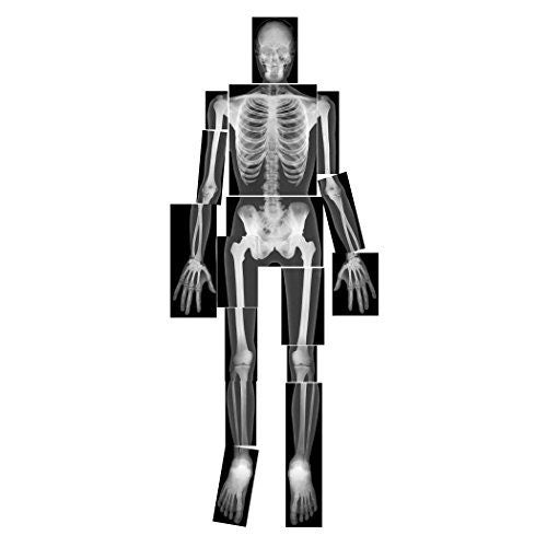 Roylco True to Life Human X Rays Carousel 1