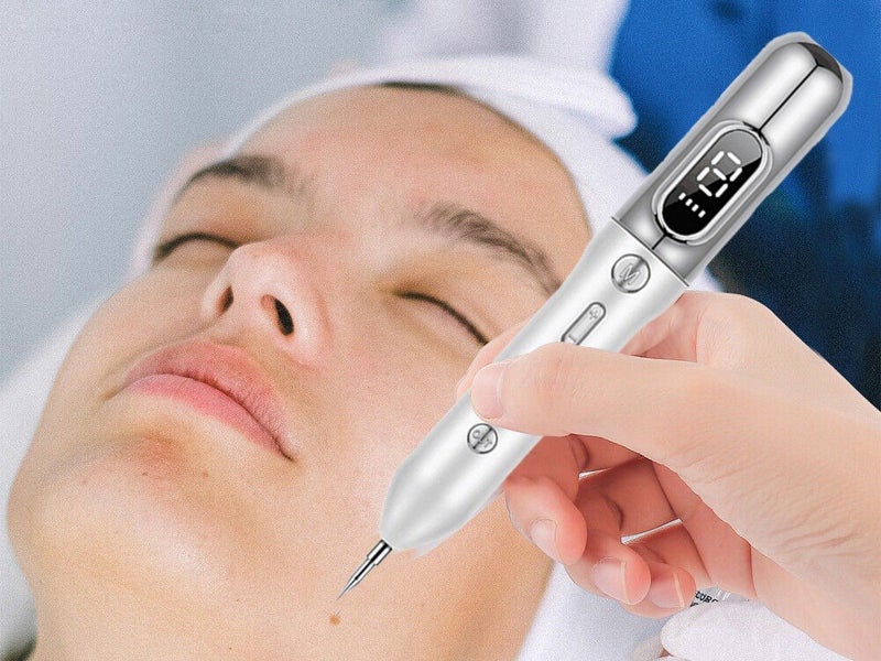 Electric Plasma Freckle Removal Pen Face Skin Dark Spot Removal Device Silver Carousel 2