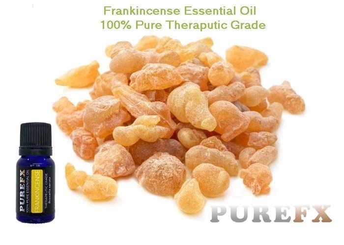 Frankincense 50ml Essential Oil 100% Pure Carousel 1