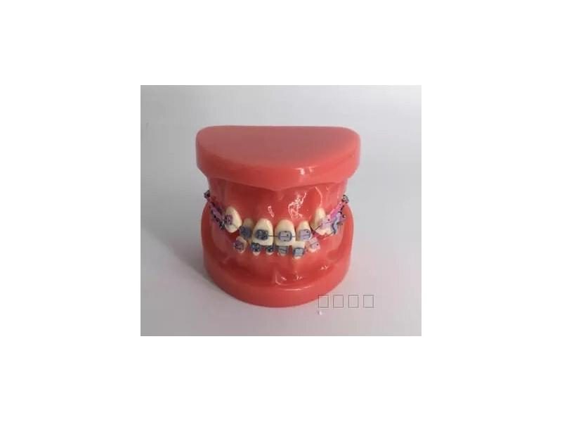 Medical Science Tooth Models Incorrect Maxillary Orthodontic Model Oral Carousel 1
