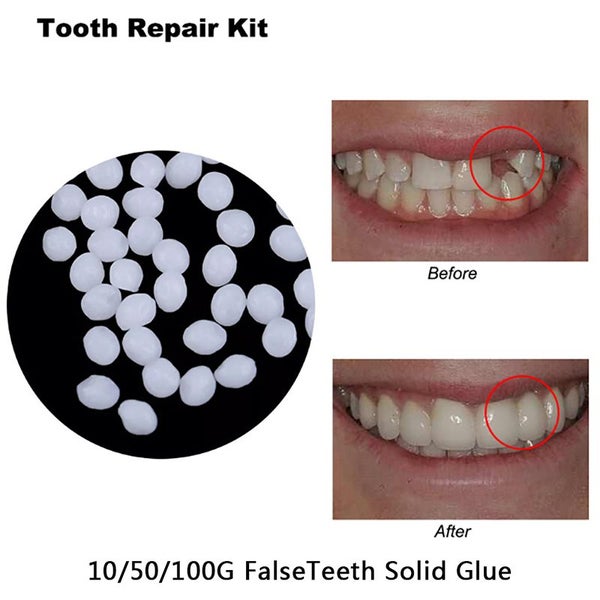 10g Teeth And Gap Falseteeth Solid Glue Resin Denture Adhesive Teeth Carousel 2