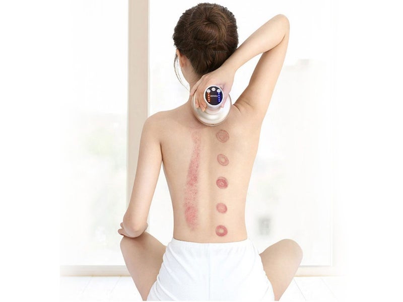 Cupping Set Electric Massager Carousel 2