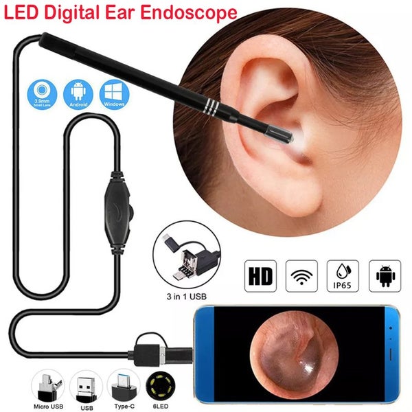 Ear Cleaning Endoscope Visual Camera Picker Medical Otoscope i2025BK0 Carousel 1