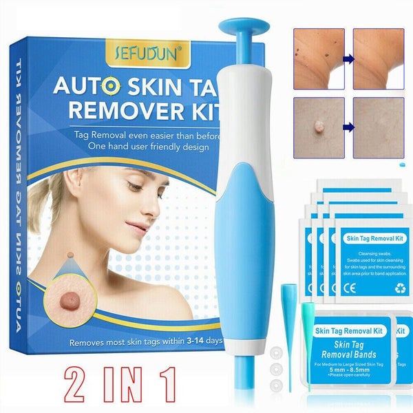 Skin Tag Remover 2-in-1 Tool Kit i2367LB0 Carousel 2