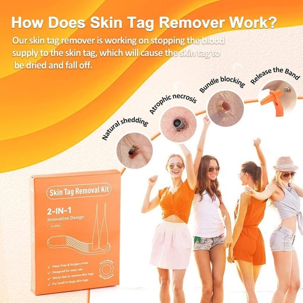 Skin Tag Mole Remover Kit i2368OG0 Carousel 12