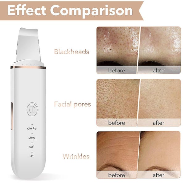 Skin Scrubber Face Skin Spatula Blackhead Remover Pore Cleaner Face Beauty Lifti Carousel 3