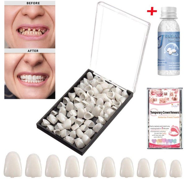 Temporary Tooth Repair Kit For Filling The Missing Broken Tooth And Gaps