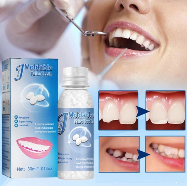 Tooth Repair Glue Shapeable Temporary Teeth Gap Filling Repair i2434MZ0 Carousel 2