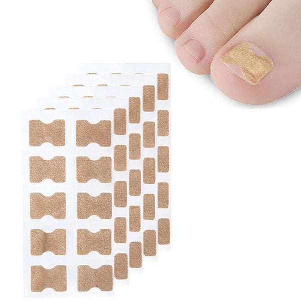 Ingrown Toenail Treatment Kit 50Pcs Toenail Correction Stickers Pedicure Tools Carousel 1