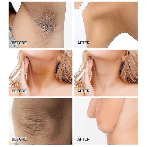 Body whitening cream, armpits, knees, dark spot cream, Carousel 2