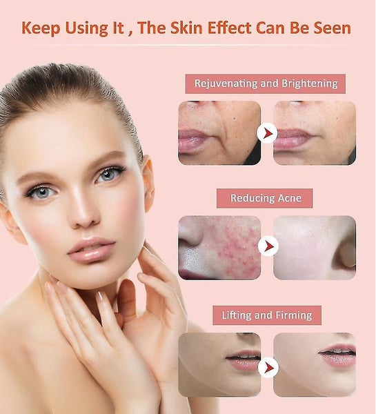 7 In 1 RF Radio Frequency Face Tightening Lifting Beauty Device Mesotherapy U Carousel 5