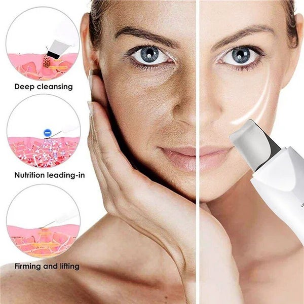 Professional Sonic Face Cleaning Spatula Portable Electric Facial Carousel 2