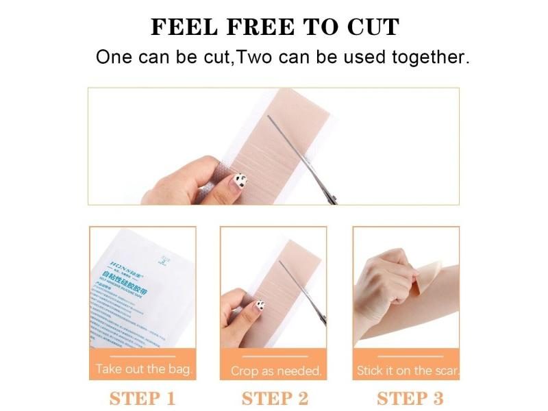 4x50cm Silicone Scars Patches For Ear Correction Surgery Scar Removal Carousel 1