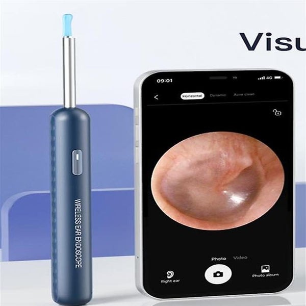 Coslus Ear Wax Removal Ear Wax Removal Tool With Camera Earwax Removal Kit Ear Carousel 3