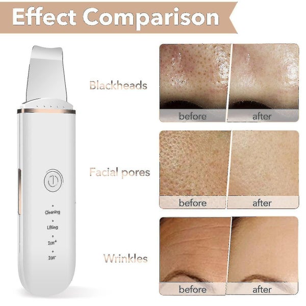 Skin Scrubber Face Skin Spatula Blackhead Remover Pore Cleaner Face Beauty Lift Carousel 5