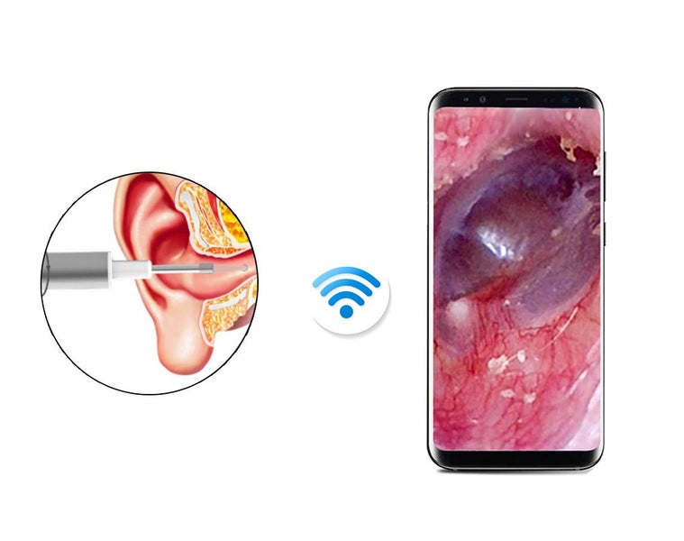 Ear Cleaner with WiFi Camera NZ Clearance Carousel 9