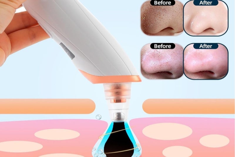 2Pcs Vacuum Blackhead Remover Facial Skin Pore Acne Pimple With 5 Suction Probes Carousel 2