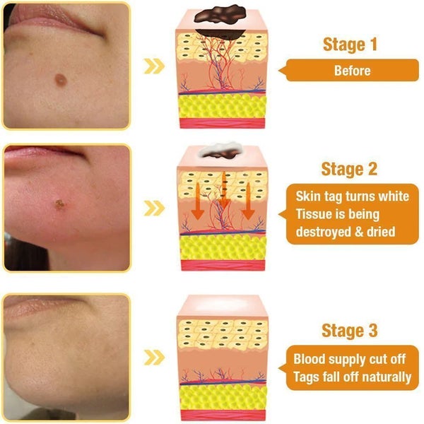 1pcs 30ml Bee Venom Treatment Cream, Tag Recede, Bee Venom Cream, for All Skin Carousel 2