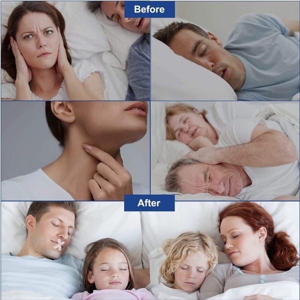 120pcs Sleep Mouth Strips Anti Snoring Devices Carousel 2