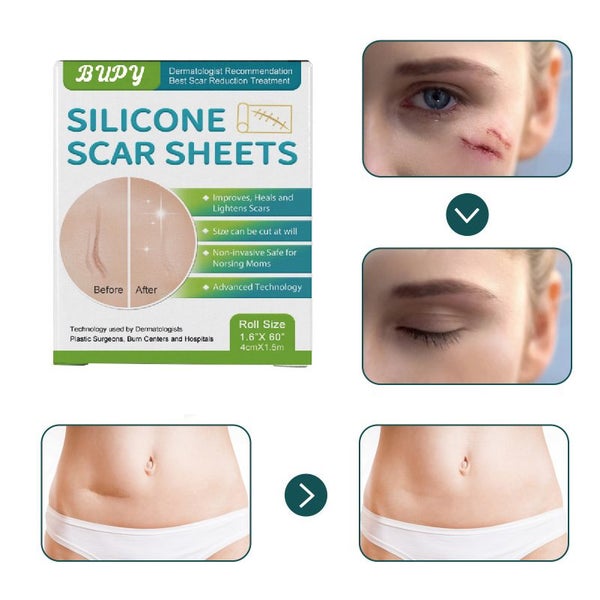 Silicone Scar Sheets Silicone Scar Tape Carousel 10