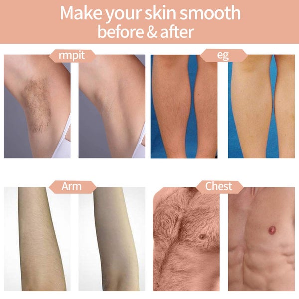 IPL Laser Hair Removal System - (NZ CLEARANCE) Carousel 7