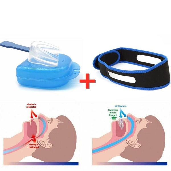 1set STOP SNORING Mouth Guard Aid Mouthpiece Sleep Apnea Bruxism Anti Snore G... Carousel 12