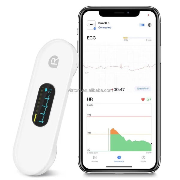 Pocket ECG Monitoring Device with OLED Screen Bluetooth EKG Monitor for Rhyth... Carousel 1