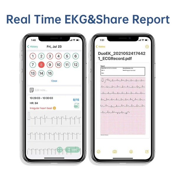 Pocket ECG Monitoring Device with OLED Screen Bluetooth EKG Monitor for Rhyth... Carousel 2
