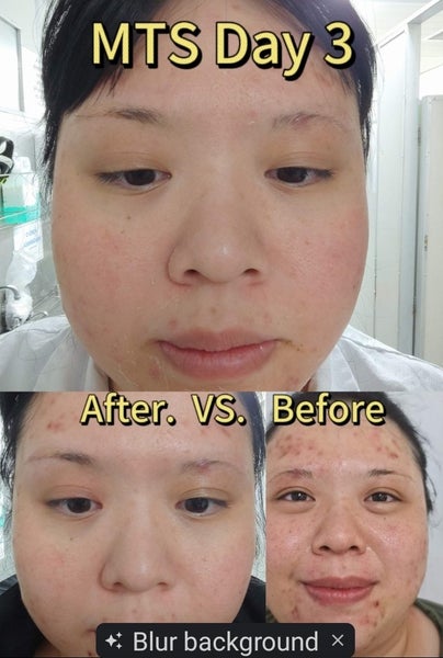 Body Massage & Skin Rejuvenation & Hair Removal Carousel 1