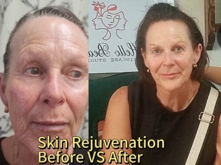 Body Massage & Skin Rejuvenation & Hair Removal Carousel 2