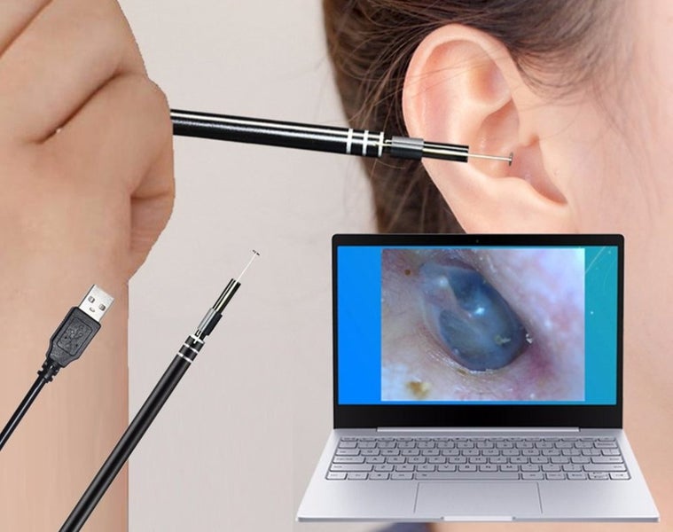 Ear Endoscope Clearance - Clearance Carousel 6