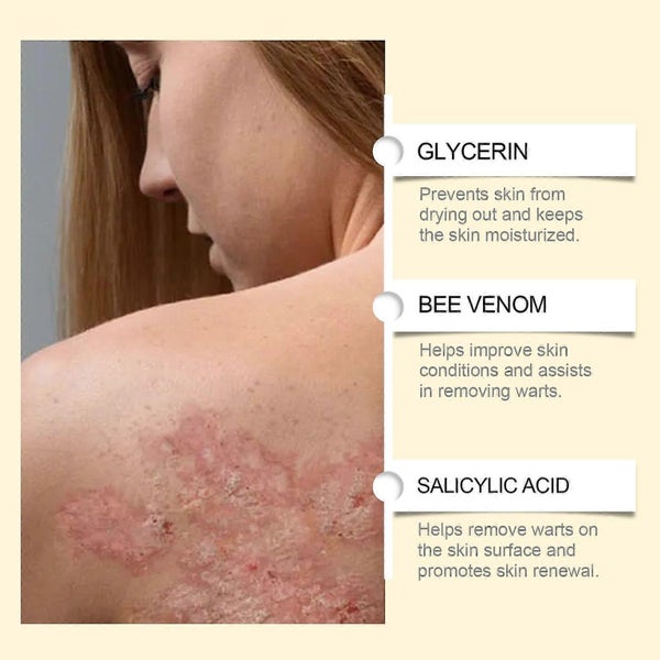Bee Venom Comprehensive Repair Cream Skin Tags Warts Moles Removal Serum Carousel 5