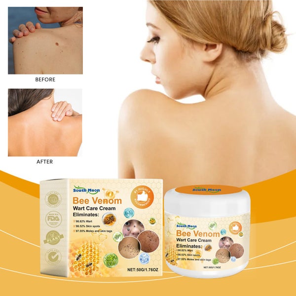 50g Bee Venom Mole Wart Remover Skin Tag Wart Mole Remover Carousel 2
