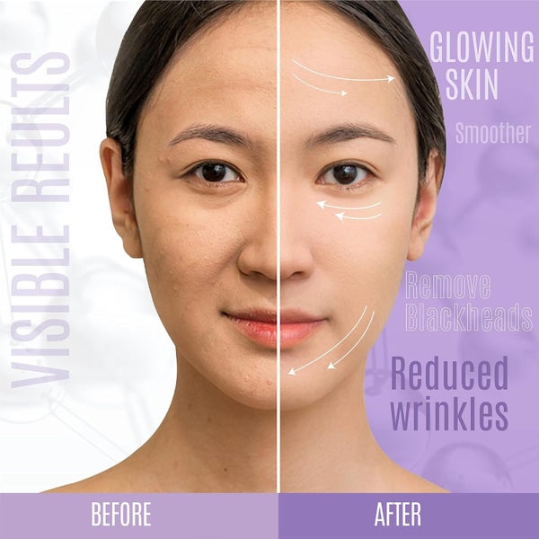 Lift And Firm - 30% Peptide Serum, Matrixyl 3000, Vitamin C & E + Hyaluron 60ML62863859872897113