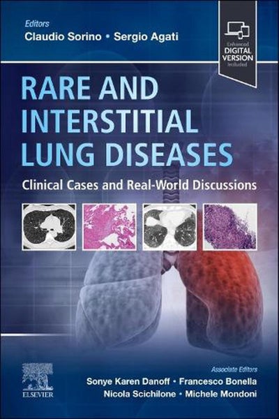Rare and Interstitial Lung Diseases by Claudio Sorino - Paperback Carousel 1