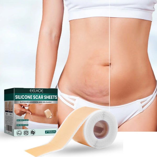 1.5m Silicone Scar Sheets Gel Tape *NZ Stock HOT Deal* Carousel 1