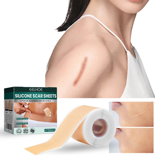 1.5m Silicone Scar Sheets Gel Tape *NZ Stock HOT Deal* Carousel 2