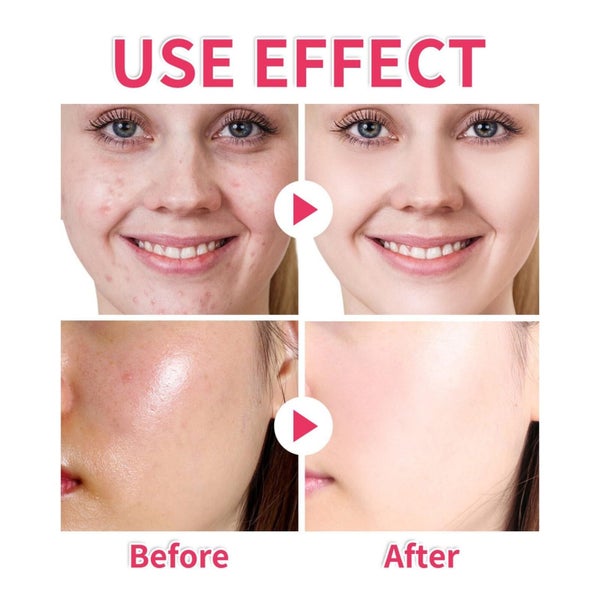 40pcs Turmeric Cleansing Pads for Dark Spots Kojic Acid and Turmeric Cleansin... Carousel 12