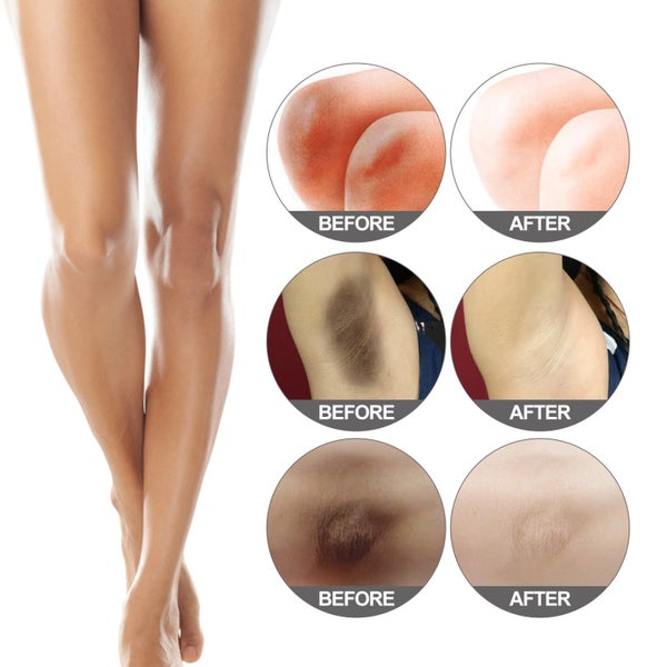 30ml Darkening Cream Jaysuing Underarm Thigh Anti-black Cream Skin Whitening Carousel 8